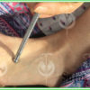 Specillo Diagnostico Universale (modello 2) - immagine 5